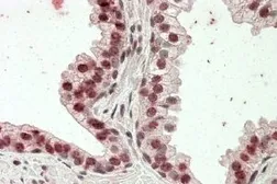 Anti-HOXD13 antibody, Internal used in IHC (Paraffin sections) (IHC-P). GTX88136