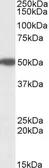 Anti-MON1A (aa478-489) antibody, Internal used in Western Blot (WB). GTX88138