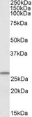 Anti-CHCHD3 antibody, Internal used in Western Blot (WB). GTX88139