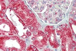 Anti-CHCHD3 (aa151-164) antibody, Internal used in IHC (Paraffin sections) (IHC-P). GTX88140
