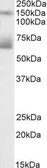 Anti-Mesothelin antibody, Internal used in Western Blot (WB). GTX88160