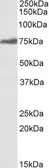 Anti-RSL1D1 antibody, Internal used in Western Blot (WB). GTX88161