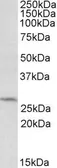 Anti-DCUN1D1 antibody, C-term used in Western Blot (WB). GTX88168