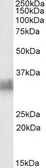Anti-CD317 antibody, Internal used in Western Blot (WB). GTX88171