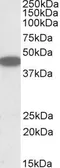 Anti-CXCR6 antibody, C-term used in Western Blot (WB). GTX88177