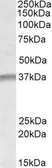 Anti-UTF1 antibody, Internal used in Western Blot (WB). GTX88180