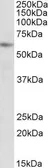 Anti-PIAS2 (aa185-196) antibody, Internal used in Western Blot (WB). GTX88188