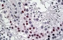 Anti-DENTT antibody, C-term used in IHC (Paraffin sections) (IHC-P). GTX88198