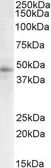 Anti-STAP2 (aa391-403) antibody, C-term used in Western Blot (WB). GTX88199