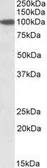 Anti-SEC23A antibody, Internal used in Western Blot (WB). GTX88211