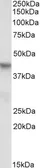 Anti-PINX1 (aa225-237) antibody, Internal used in Western Blot (WB). GTX88230