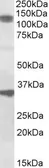 Anti-CCAR1 antibody, Internal (near C-Terminus) used in Western Blot (WB). GTX88234
