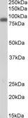 Anti-Zyxin antibody, Internal used in Western Blot (WB). GTX88237