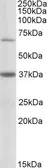 Anti-CPT2 (aa406-418) antibody, Internal used in Western Blot (WB). GTX88238