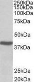Anti-ACAT1 (aa253-266) antibody, Internal used in Western Blot (WB). GTX88247