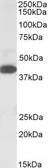 Anti-A4GNT antibody, C-term used in Western Blot (WB). GTX88249