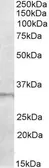 Anti-E2F6 antibody, C-term used in Western Blot (WB). GTX88255