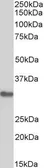 Anti-EB3 antibody, Internal used in Western Blot (WB). GTX88277