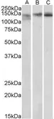 Anti-SA2 antibody, Internal used in Western Blot (WB). GTX88304