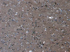 Anti-PCDH11 antibody, Internal used in IHC (Paraffin sections) (IHC-P). GTX88306