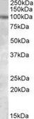 Anti-Polycystin 2 antibody, Internal used in Western Blot (WB). GTX88317