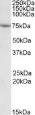 Anti-AARSD1 antibody, Internal used in Western Blot (WB). GTX88320