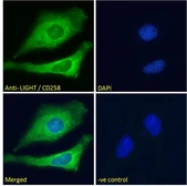 Anti-LIGHT antibody, Internal used in Immunocytochemistry/ Immunofluorescence (ICC/IF). GTX88321