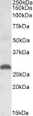 Anti-PLGF antibody, Internal used in Western Blot (WB). GTX88328