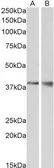 Anti-Wnt9b antibody, Internal used in Western Blot (WB). GTX88330