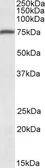 Anti-URP2 antibody, C-term used in Western Blot (WB). GTX88332