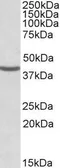Anti-NUDC antibody, Internal used in Western Blot (WB). GTX88334