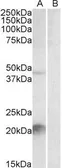 Anti-Kallikrein 6 antibody, C-term used in Western Blot (WB). GTX88341