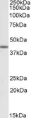 Anti-TAF7L antibody, Internal used in Western Blot (WB). GTX88345