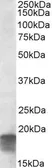 Anti-SDHAF1 antibody, C-term used in Western Blot (WB). GTX88354