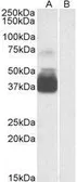 Anti-P2X7 antibody, N-term used in Western Blot (WB). GTX88360