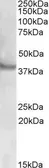 Anti-Rapsyn antibody, N-term used in Western Blot (WB). GTX88362