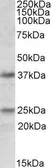 Anti-Podoplanin antibody, Internal used in Western Blot (WB). GTX88363