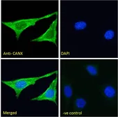 Anti-Calnexin antibody, Internal (near N-term) used in Immunocytochemistry/ Immunofluorescence (ICC/IF). GTX88369