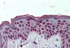 Anti-HMGA1 (aa9-21) antibody, Internal (near N-term) used in IHC (Paraffin sections) (IHC-P). GTX88373