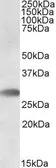 Anti-TREML1 antibody, C-term used in Western Blot (WB). GTX88375