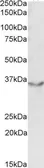 Anti-JAM-B antibody, Internal used in Western Blot (WB). GTX88378
