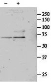 Anti-SRF antibody, Internal used in Western Blot (WB). GTX88384