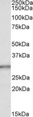 Anti-Carbonic Anhydrase 1 antibody, Internal used in Western Blot (WB). GTX88385