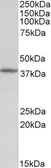Anti-Decorin antibody, Internal used in Western Blot (WB). GTX88387
