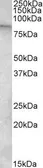 Anti-TRPC4AP antibody, Internal used in Western Blot (WB). GTX88389