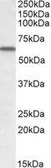 Anti-Vitamin D Binding Protein antibody, Internal (near the N-term) used in Western Blot (WB). GTX88396