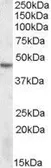 Anti-DRAK2 antibody, Internal used in Western Blot (WB). GTX88405