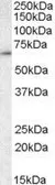 Anti-TCP1 gamma antibody, C-term used in Western Blot (WB). GTX88407