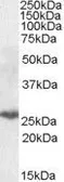 Anti-PSMB10 antibody, Internal used in Western Blot (WB). GTX88408