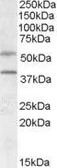 Anti-GPR81 antibody, Internal used in Western Blot (WB). GTX88409